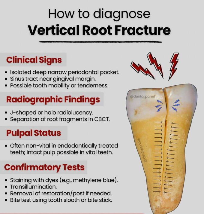 VRF Diagnosis