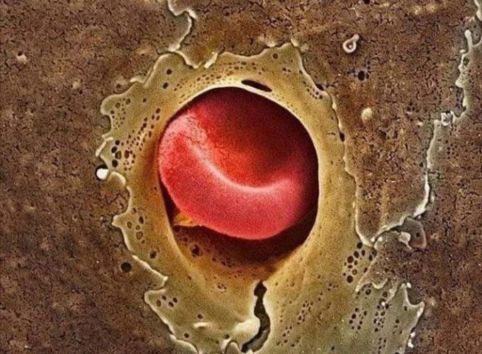 The elasticity of erythrocytes allows them to enter the norrow capillaries