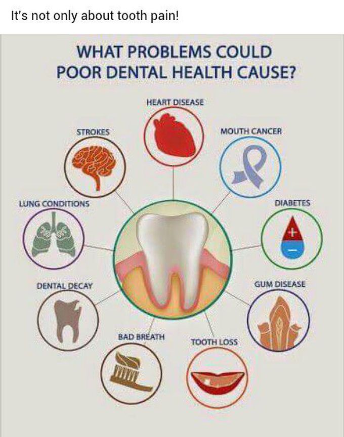 Its not always a toothache