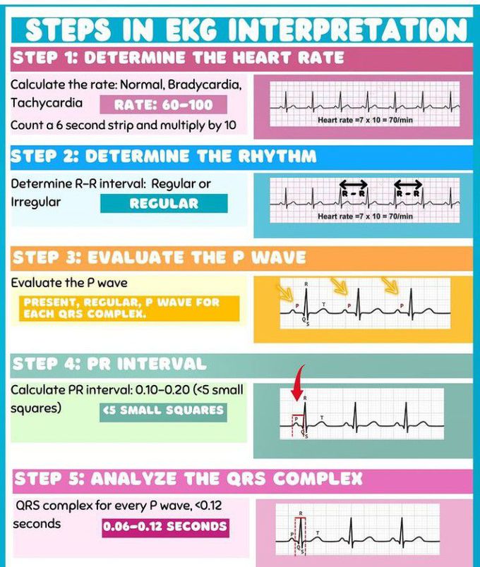 Steps in EKG interpretation