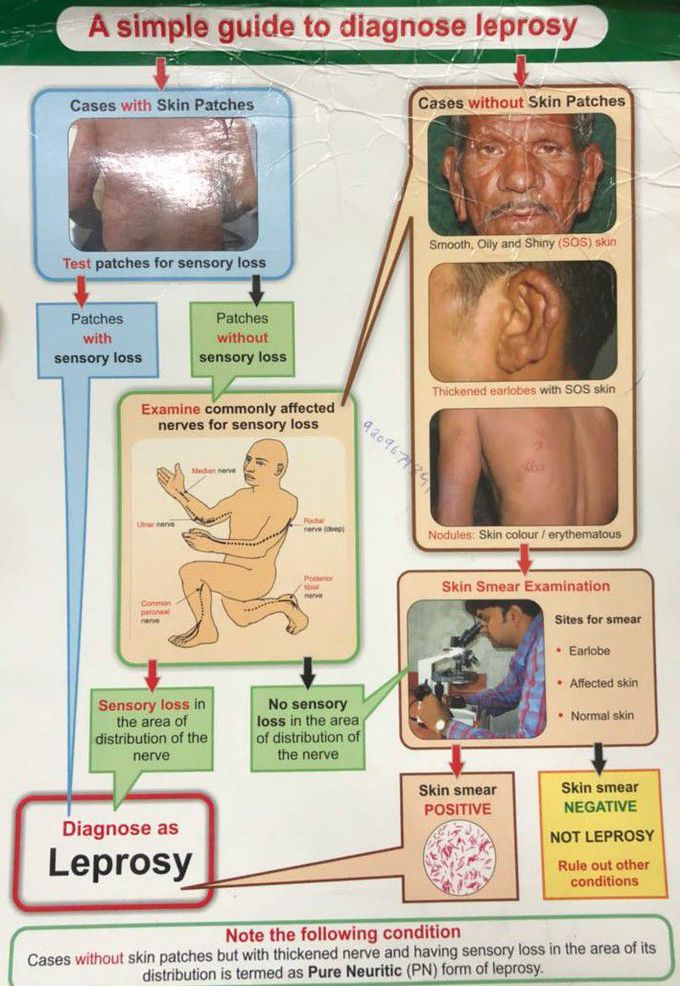 diagnosis-of-leprosy-medizzy