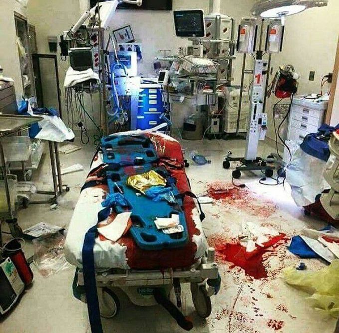 This is a graphic but powerful image that has been circulating the web. It's a picture that emphasizes the hard times, challenges and sometimes absolute chaos doctors,nurses, EMT's and other health care providers are facing in the process of saving a life-or atleast trying to. This is a room where actions are made and a room that helps transform a hospital from a symbol of sickness and despondency to a place of hope and cure.