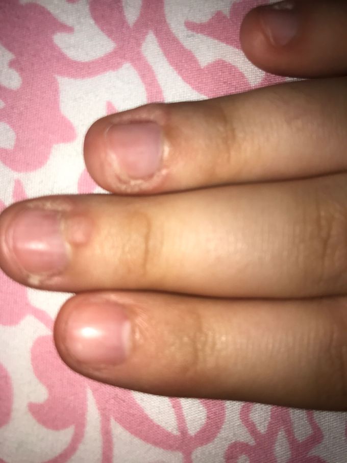 Diagnosis? Treatment?
